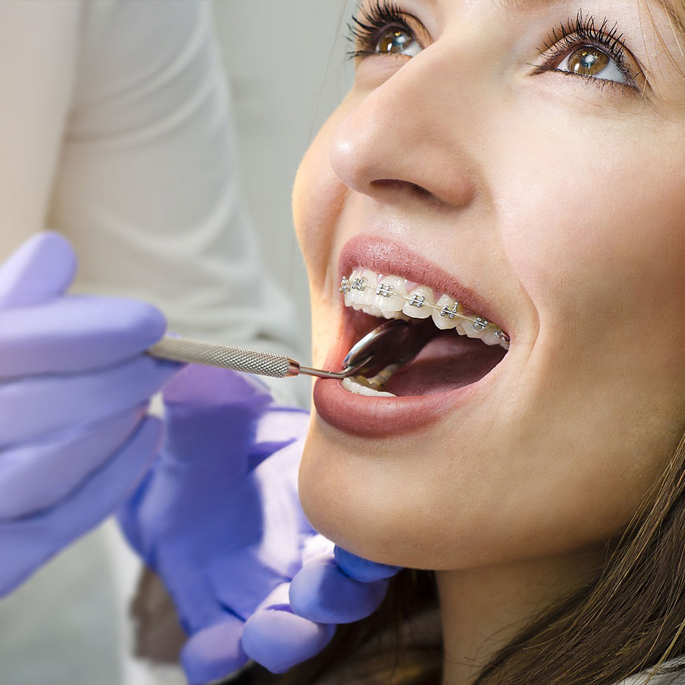 تقويم الأسنان